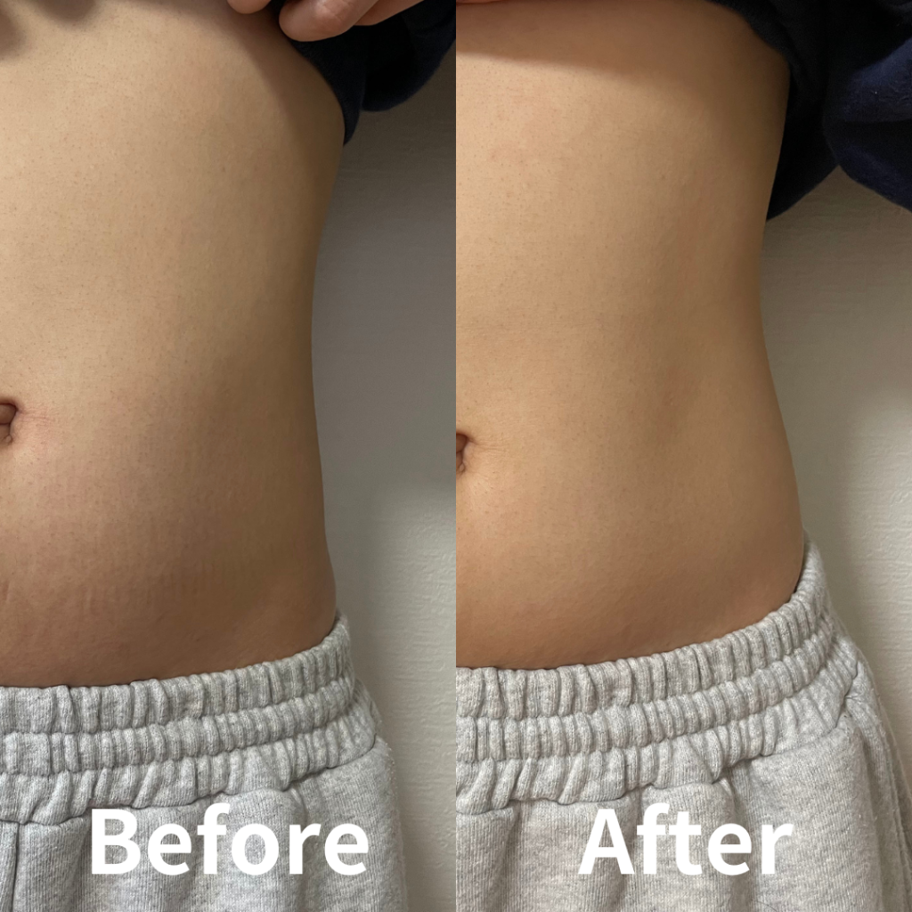 LAF整体パーソナルジム　BeforeAfter